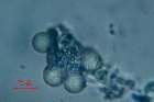 Microscopia - Pithya vulgaris  (2)